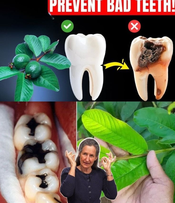 Guava Leaves for Tooth Decay: 3 Simple and Affordable Home Remedies