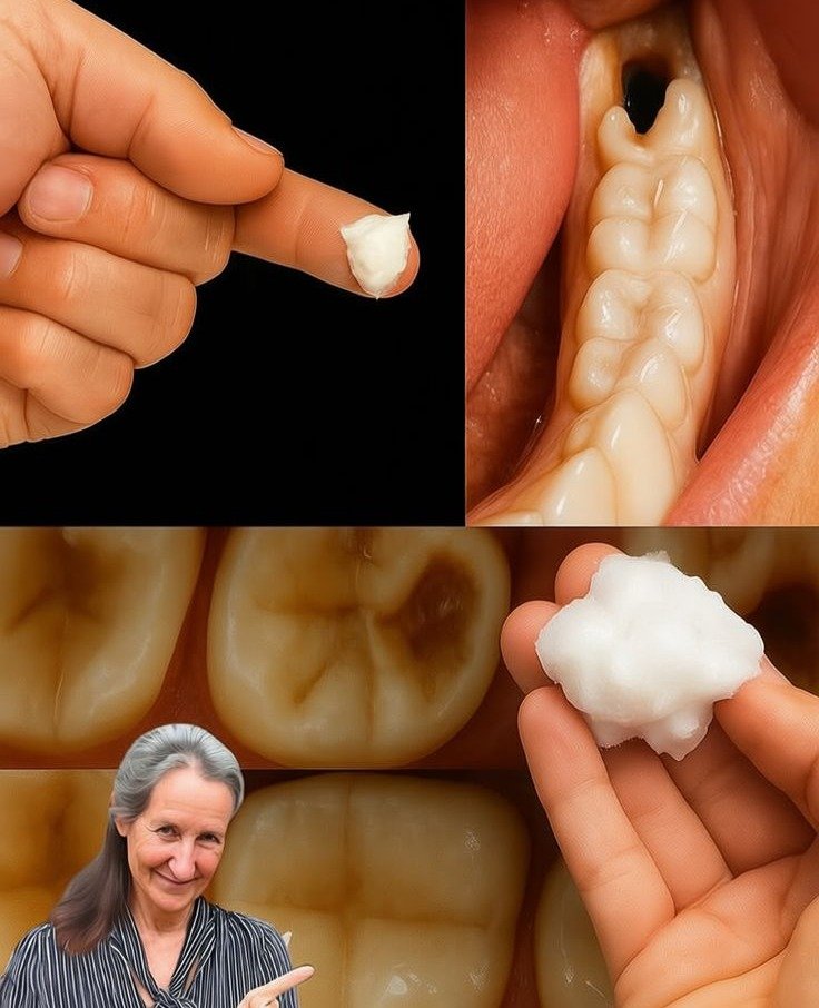 Tired of Tooth Decay? Discover 5 Natural Ways to Fortify and Safeguard Your Smile