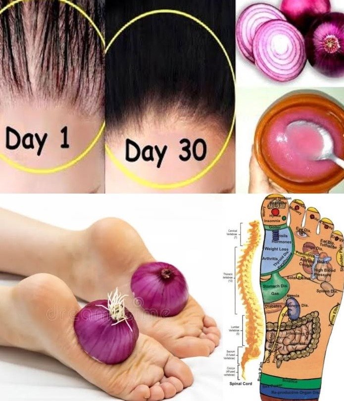 14 Smart Ways Onions Can Enhance Your Health at Home