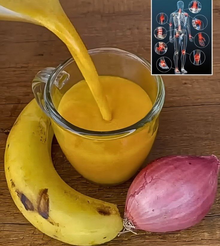 Harnessing Nature’s Power: Onion and Banana for Natural Joint Pain Relief and Enhanced Mobility